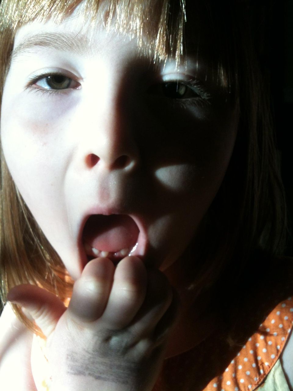 Yessa's First Tooth Gone!