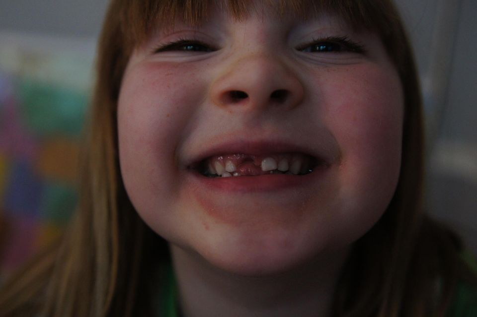 Another Tooth Gone