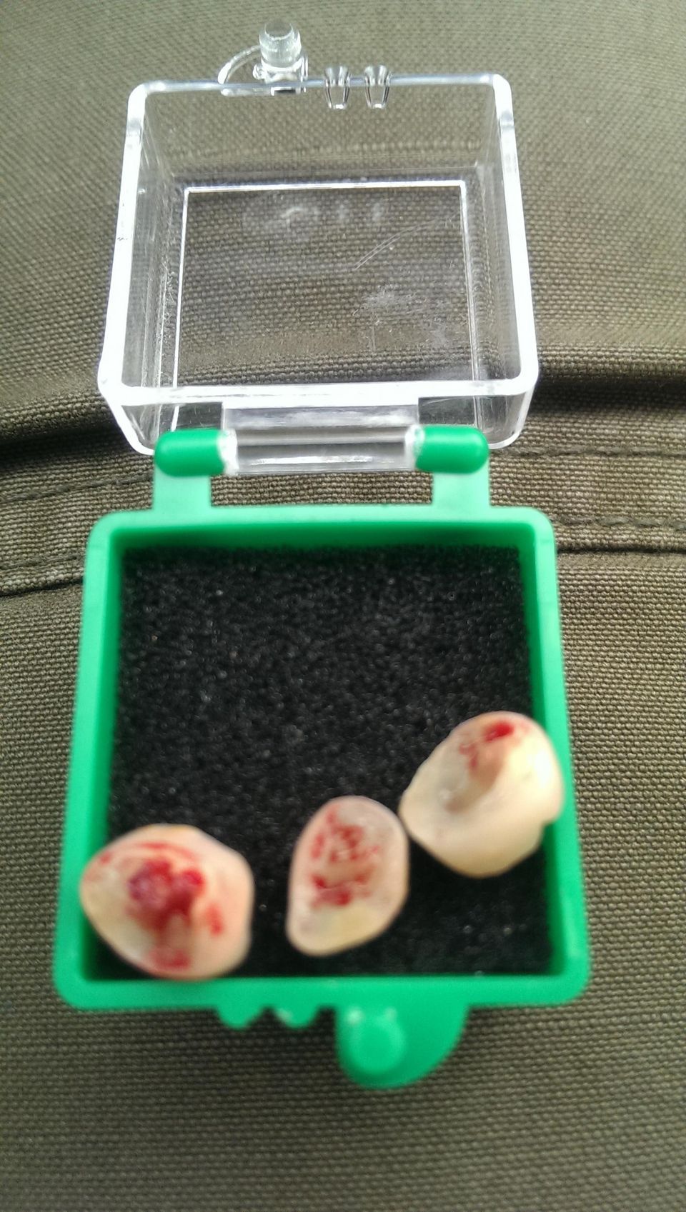 Can't Call Her Jaws Anymore