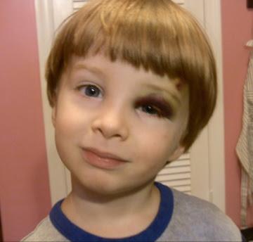 "Wooden't you love to do better?"