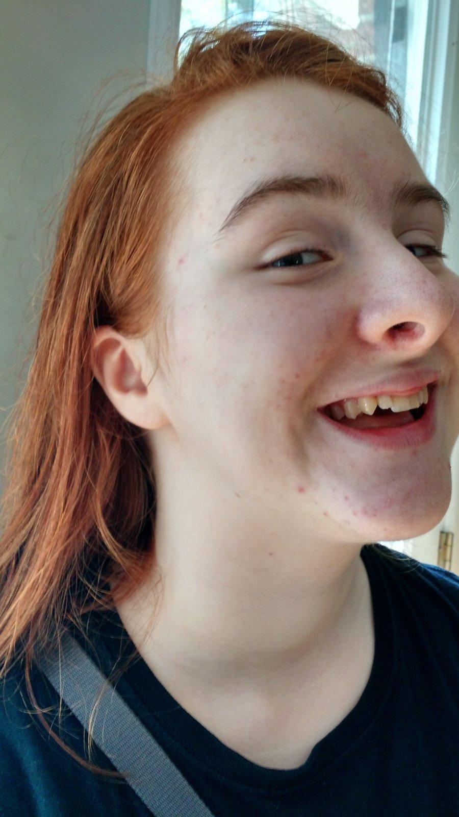The sweet, unpunctured ear lobes.